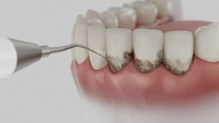 Trusted Teeth Cleaning And Checkup service in Gamewell, NC - Dentist Open Now